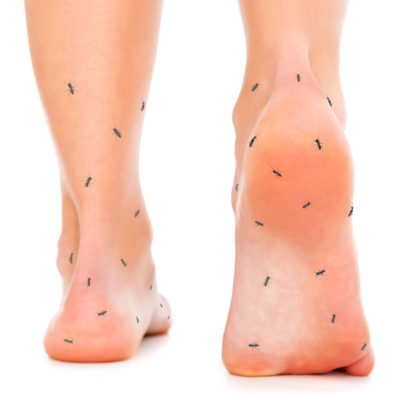 Diabète et neuropathie